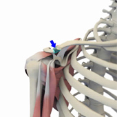 Distal Clavicle Excision