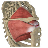 Massive Retracted Rotator Cuff Tear