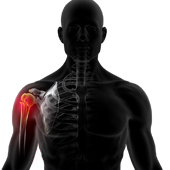 Shoulder Fracture Care