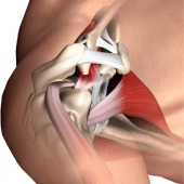 Subacromial Decompression