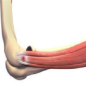 Tennis Elbow Surgery