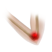 UCL Reconstruction